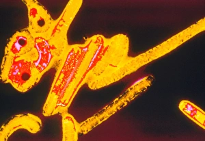 Coloured TEM of Ebola viruses Coloured TEM of Ebola viruses