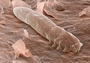 Eyelash mite, SEM Eyelash mite, SEM