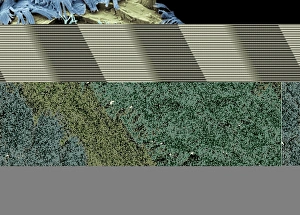Woodlouse leg, SEM Woodlouse leg, SEM